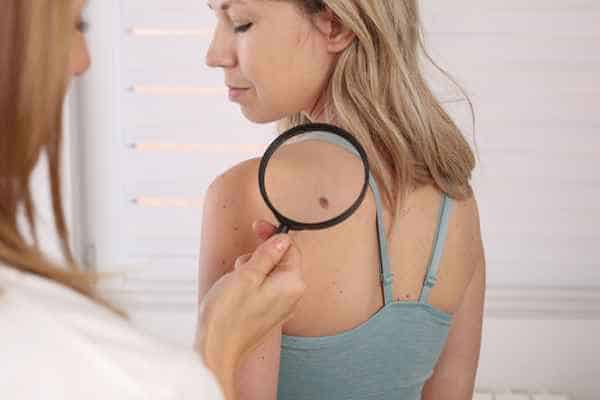What Are Traditional Skin Lesion Removal Methods Port Glasgow?