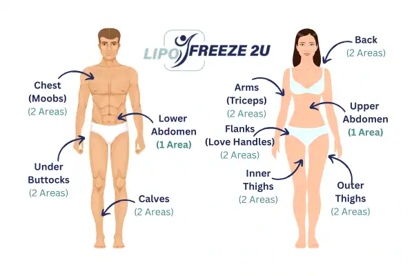 Areas you can have fat freezing treatment Port Glasgow